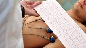 Imagen de <p>Evaluaci&oacute;n sistema cardiovascular</p>
